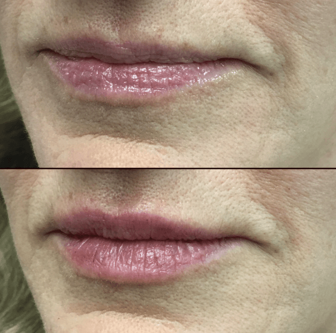 LumiLips – Long Lasting Moisture Lock Lipstick – image 7