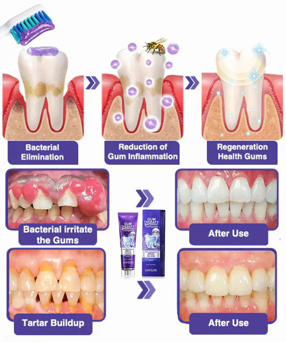 Dentova – Bee Venom Dental Care Toothpaste – image 6