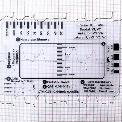 MediTrack – Professional ECG Assessment Pocket Guide – ECG 7 Step Ruler / Buy 1 Get 30% OFF