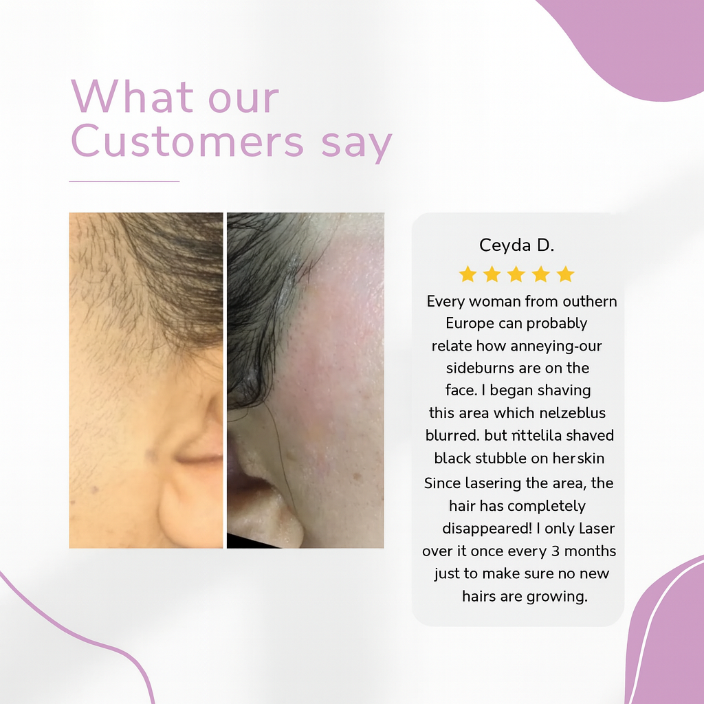 GlowEase - IPL Hair Remover for Effortless Smooth Skin – image 9