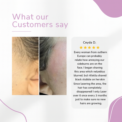 GlowEase - IPL Hair Remover for Effortless Smooth Skin – image 9