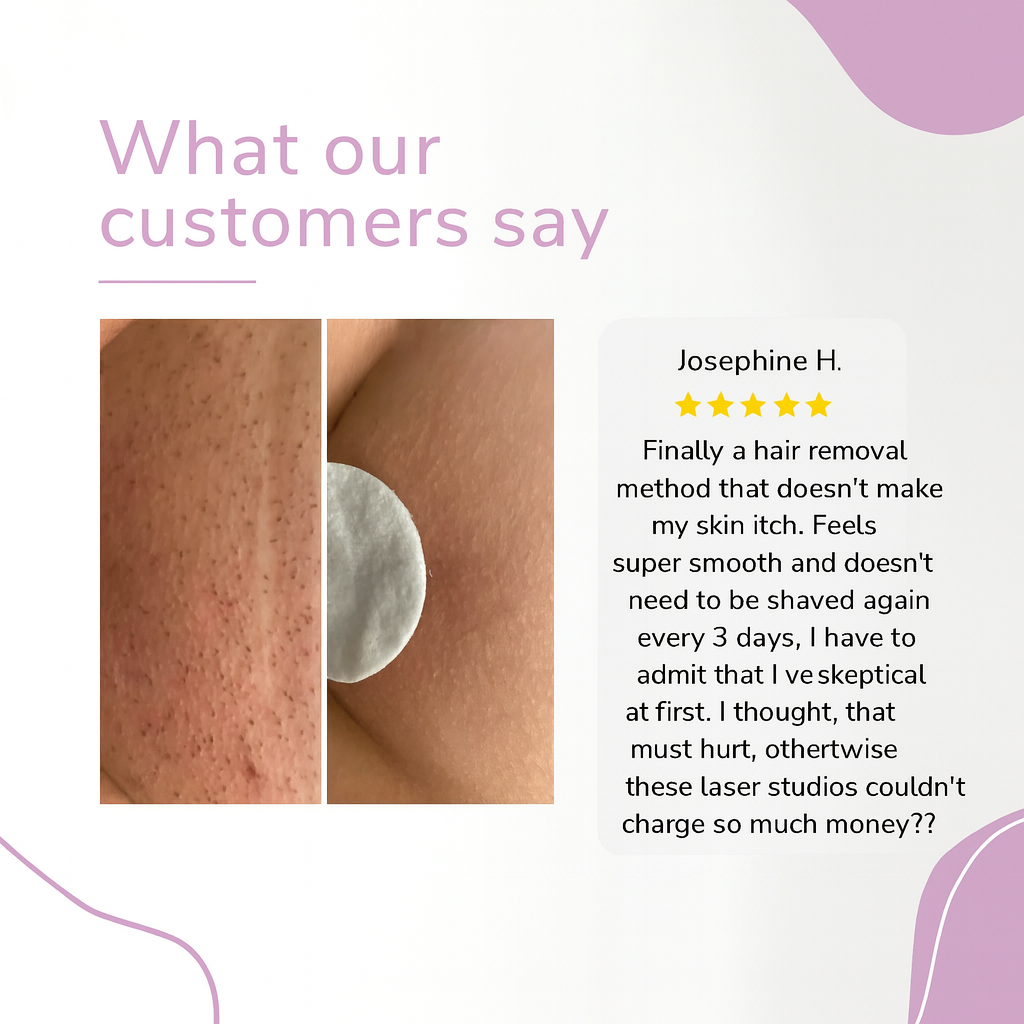 GlowEase - IPL Hair Remover for Effortless Smooth Skin – image 10