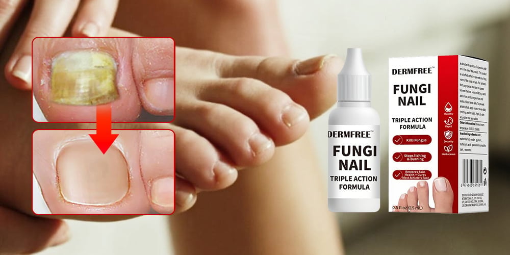 PureRoot – Extra Strength Toenail Treatment – image 7