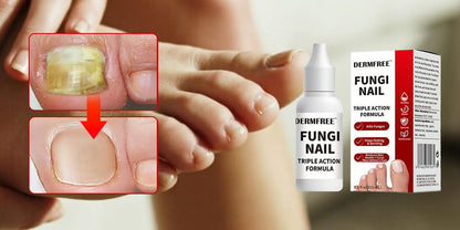 PureRoot – Extra Strength Toenail Treatment – image 7