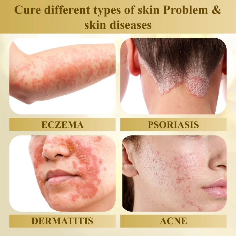DermaVenom – Advanced Skin Repair Cream – image 3