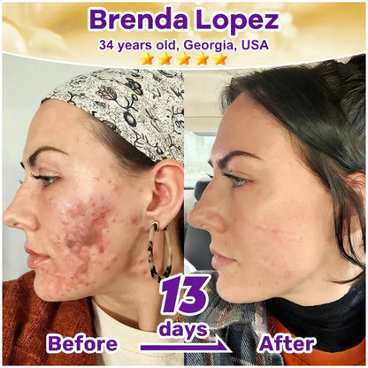 SkinRevive – Biotin 10-in-1 Skin Restoration Cream – image 14
