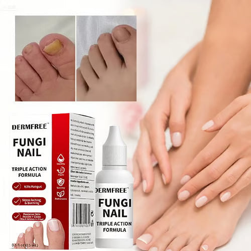 PureRoot – Extra Strength Toenail Treatment – image 2