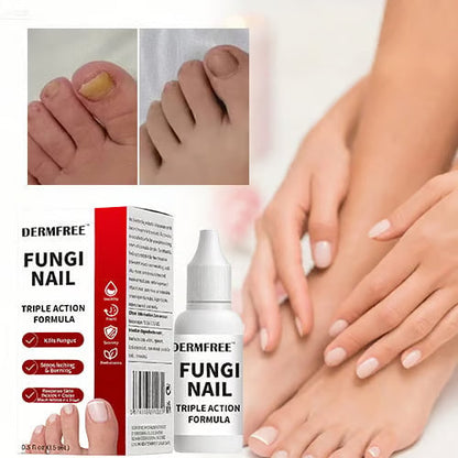 PureRoot – Extra Strength Toenail Treatment – image 2