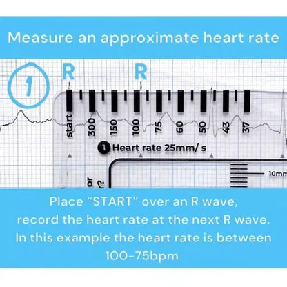 MediTrack – Professional ECG Assessment Pocket Guide – image 3