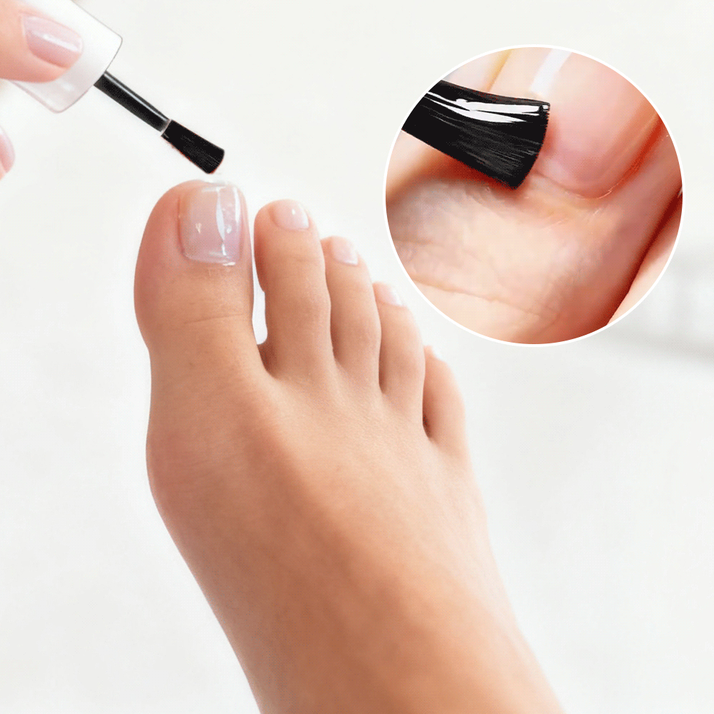 NailRenew - Natural Antifungal Nail Repair Solution – image 4
