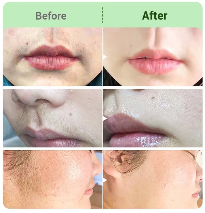 DermaSilk – Sensitive Skin Hair Cream – image 5