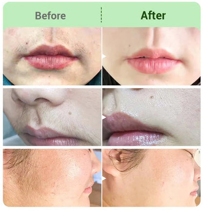 DermaSilk – Sensitive Skin Hair Cream – image 5