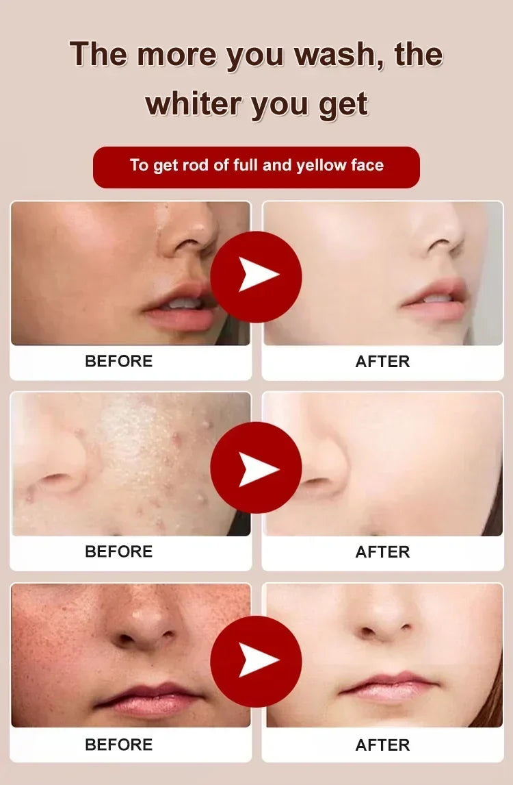 TitanClear – Intensive Purifying & Brightening Cleanser – image 9