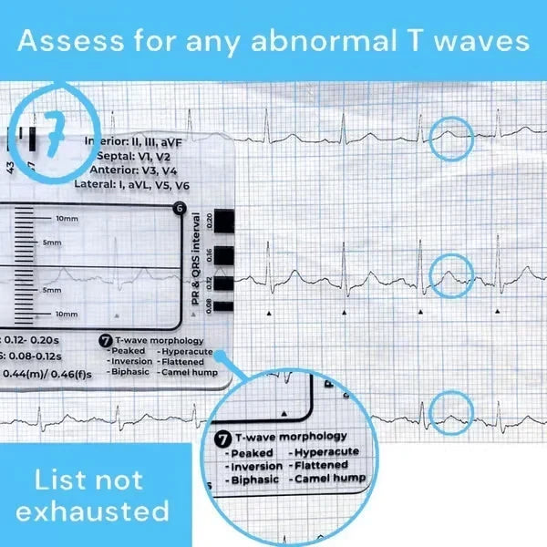 MediTrack – Professional ECG Assessment Pocket Guide – image 8