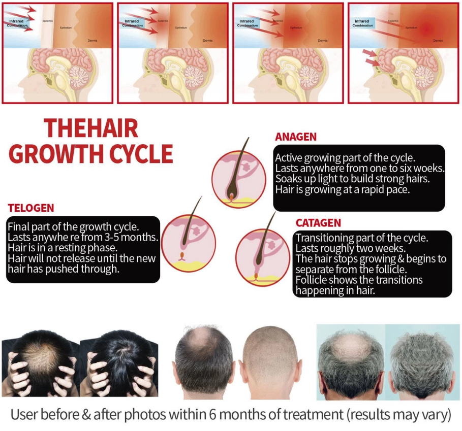 HairLuxe – Multi Mode Hair Wellness Cap – image 13