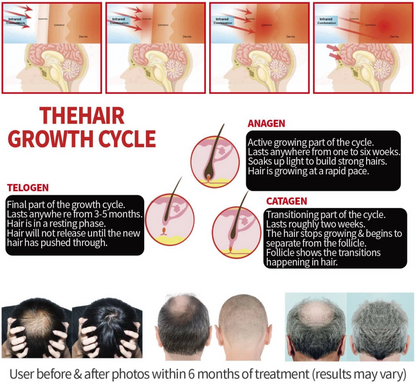 HairLuxe – Multi Mode Hair Wellness Cap – image 13