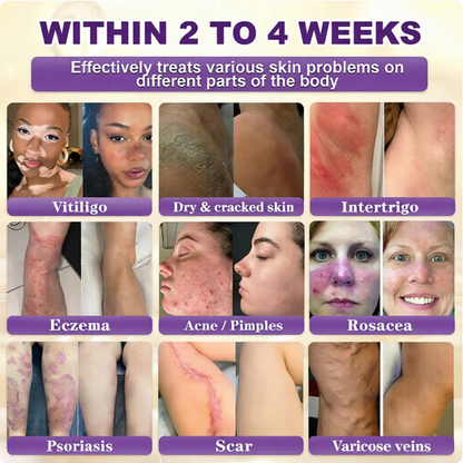 SkinRevive – Biotin 10-in-1 Skin Restoration Cream – image 2