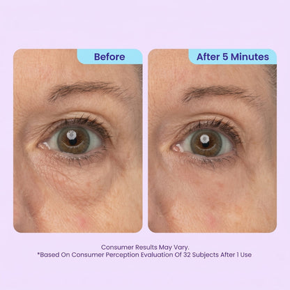 BrightLift – Instant Eye Rejuvenator – image 6