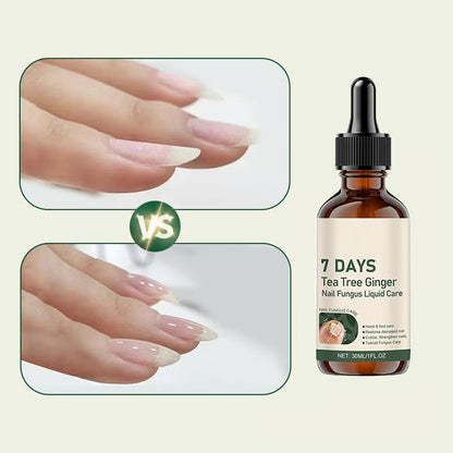 BeautyTips – Nail Repair – image 5