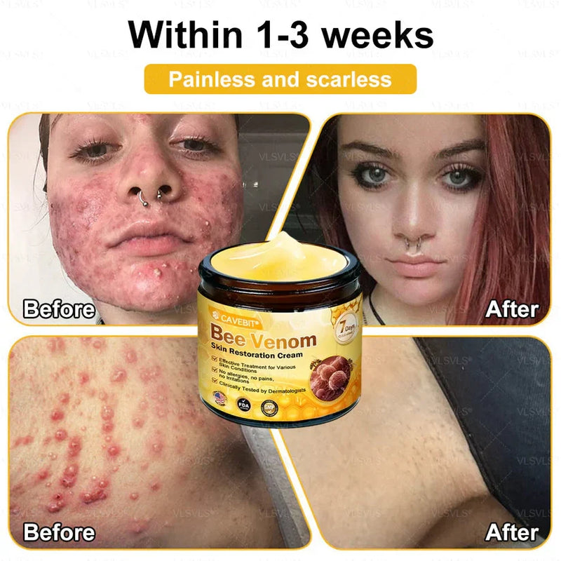 BeeLuxe – Premium Bee Venom Firming Face Cream – image 18