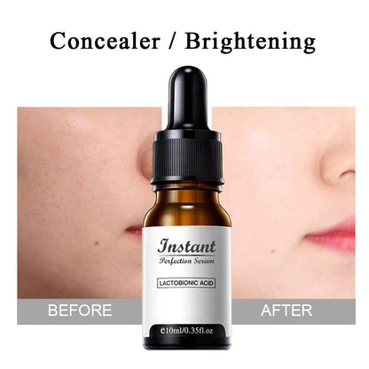 DermaYouth – Argireline Anti-Aging Formula – image 3