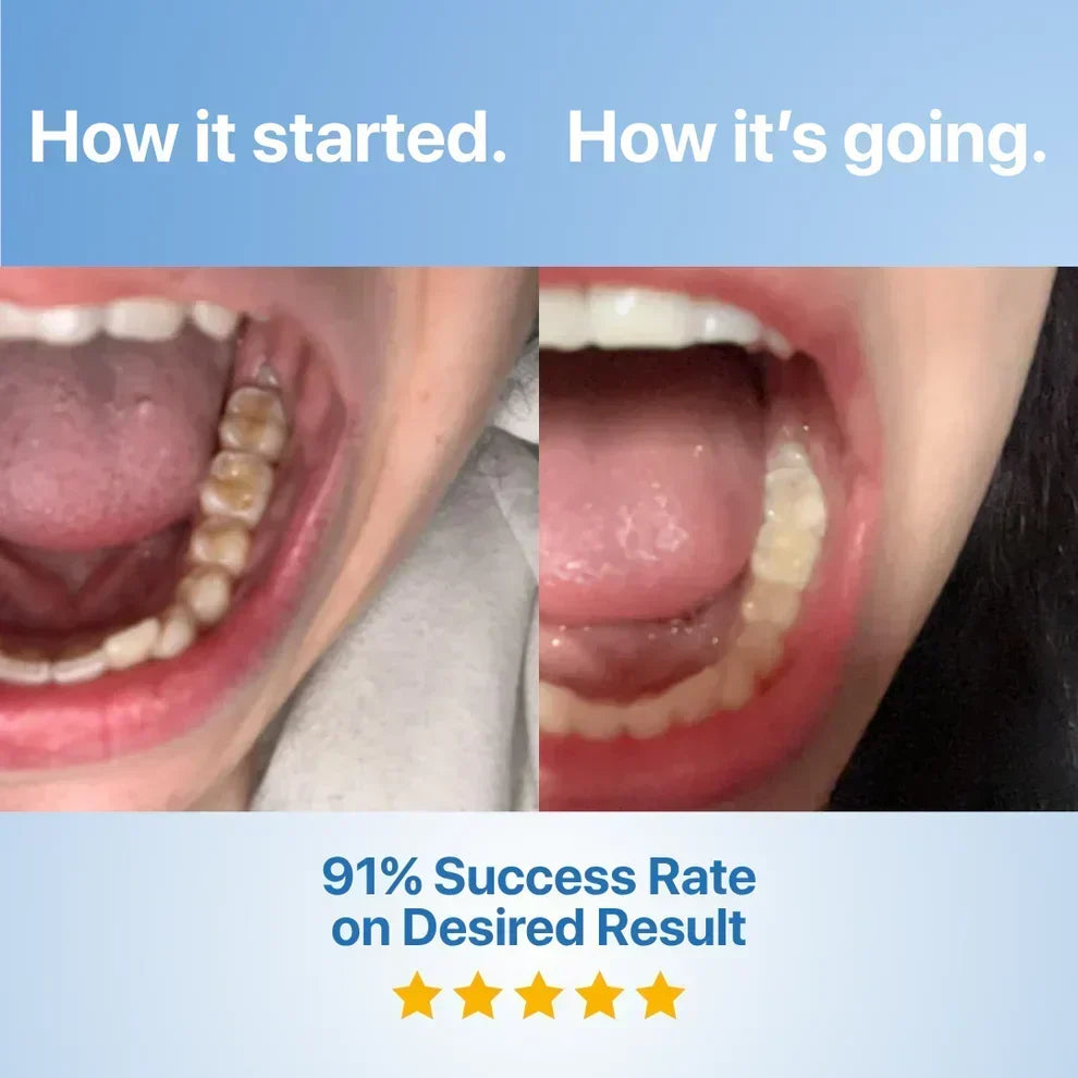 DentiGlow – Fluoride Free Tooth Repair Formula – image 7