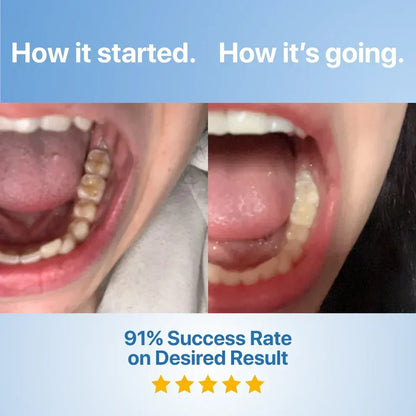 DentiGlow – Fluoride Free Tooth Repair Formula – image 7