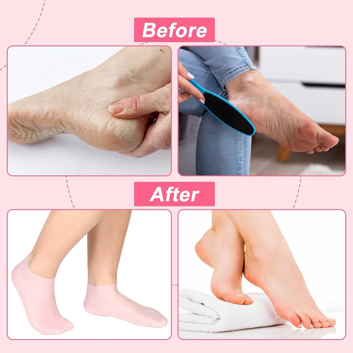 VelvetHeel Socks – Smooth Skin Foot Care – image 5
