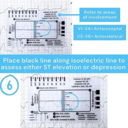 MediTrack – Professional ECG Assessment Pocket Guide – image 7