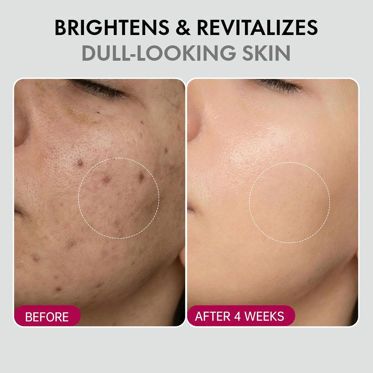 DermaGlow – Advanced Skin Renewing Treatment Cream – image 8