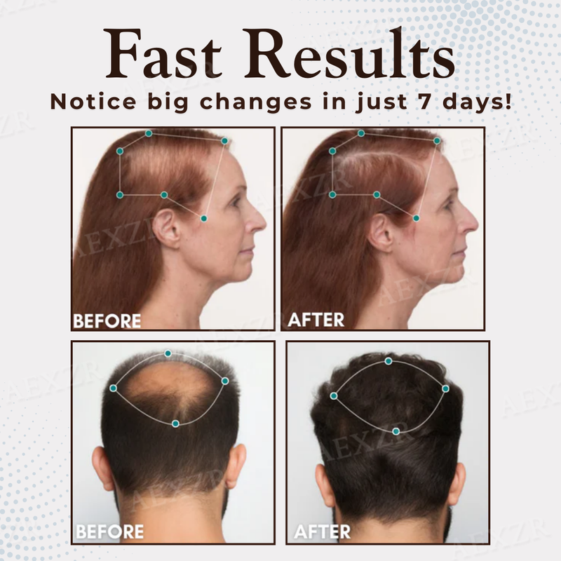 ThriveHair – Premium Hair Growth & Strength Formula – image 3