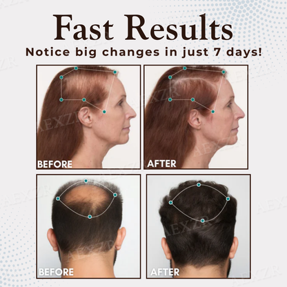 ThriveHair – Premium Hair Growth & Strength Formula – image 3
