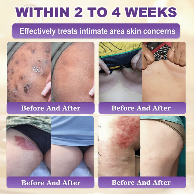 SkinRevive – Biotin 10-in-1 Skin Restoration Cream – image 4