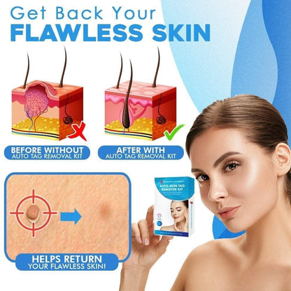 TagGone - Quick & Safe Skin Tag Remover – image 3
