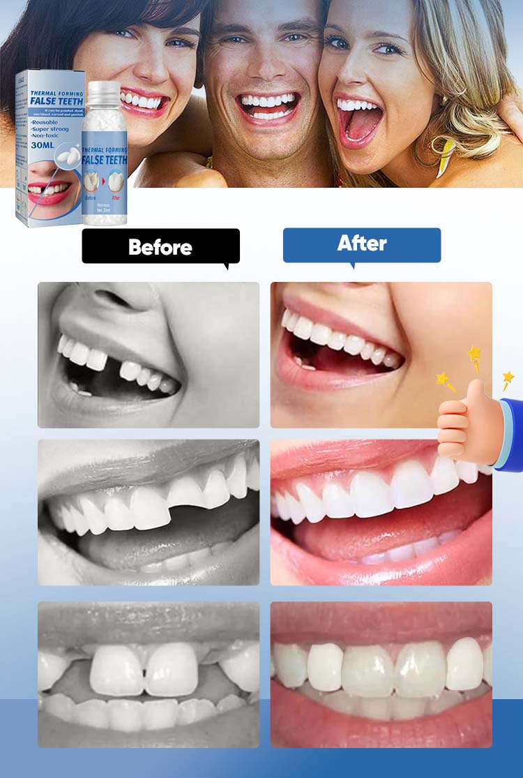 DentaForm – Custom Fit Instant Tooth Filling Solution – image 7