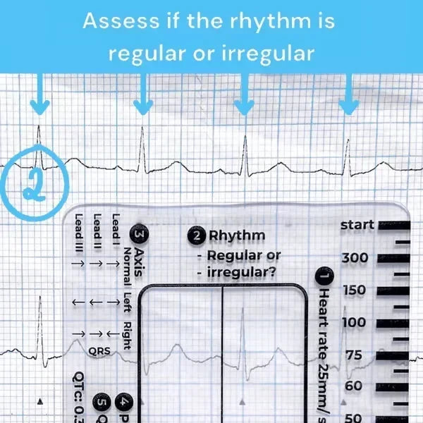 MediTrack – Professional ECG Assessment Pocket Guide – image 4