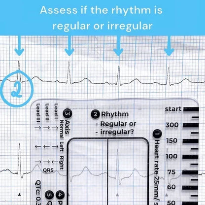 MediTrack – Professional ECG Assessment Pocket Guide – image 4