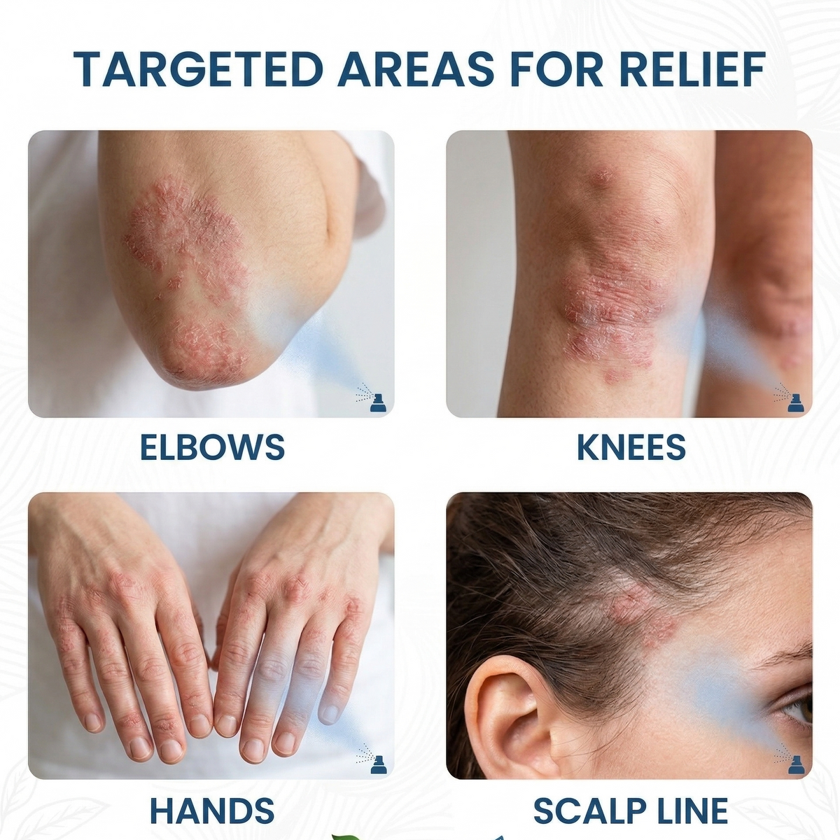 DermaCalm – Magnesium Botanical Spray – image 2