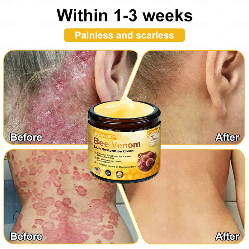 BeeLuxe – Premium Bee Venom Firming Face Cream – image 12