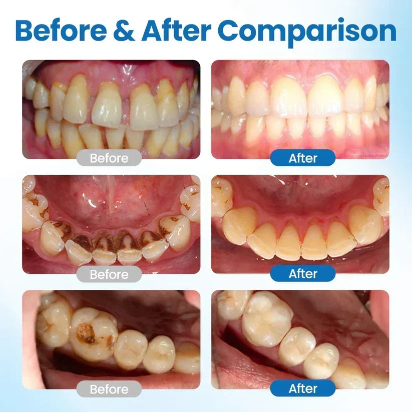 NESLEMY™ NanoHAP Tooth Defense Serum – image 5