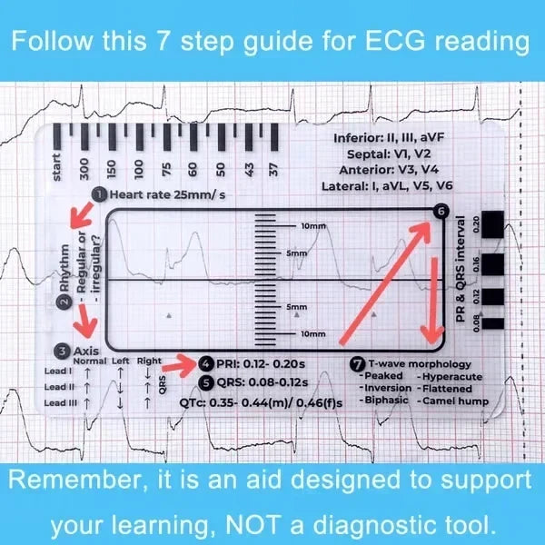 MediTrack – Professional ECG Assessment Pocket Guide – image 2
