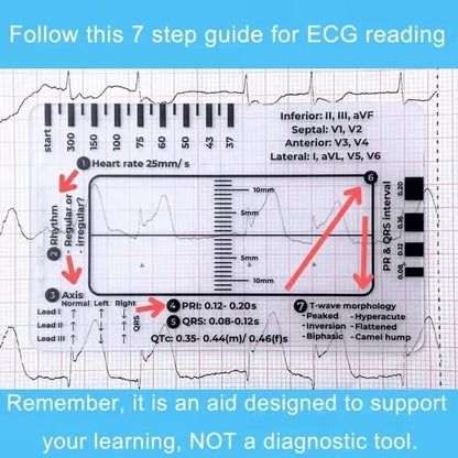 MediTrack – Professional ECG Assessment Pocket Guide – image 2