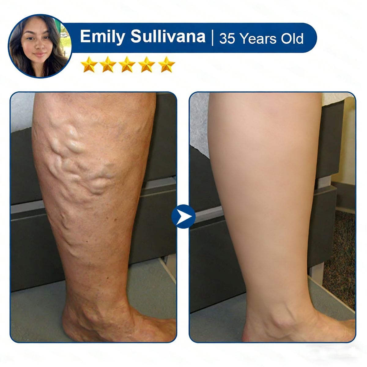 LegEase – Comfortable Vein Care Patch System – image 12