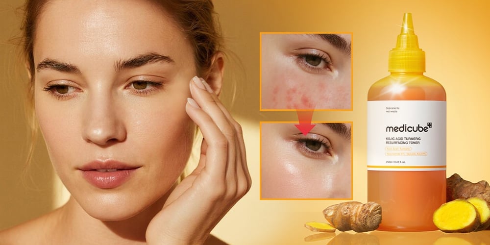 PureGlow – Kojic Acid Herbal Brightening Serum – image 6