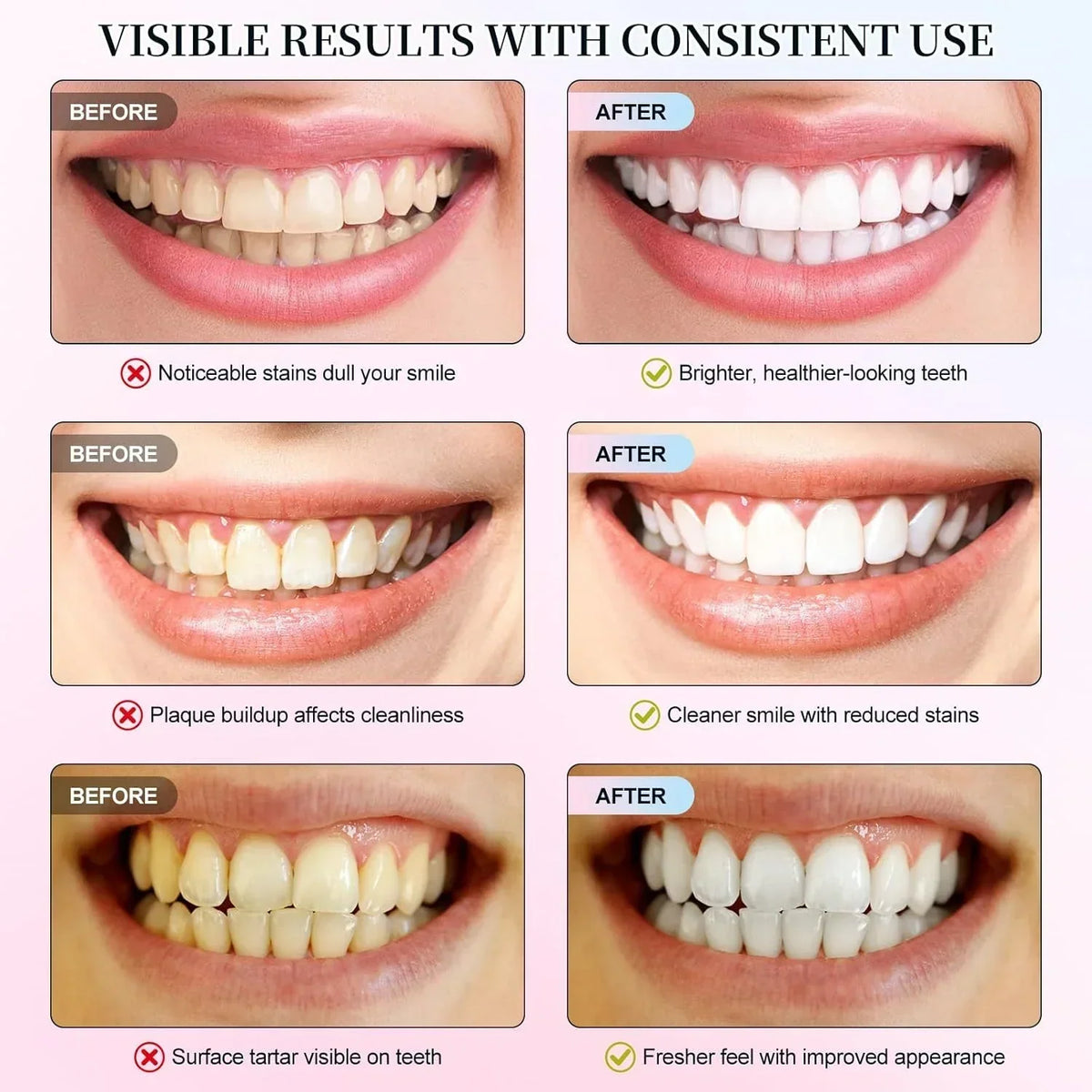 Niacinamide Whitening Toothpaste – Stain Removal & Fresh Breath – image 5