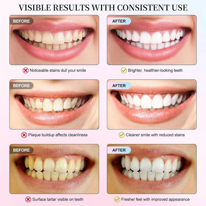 Niacinamide Whitening Toothpaste – Stain Removal & Fresh Breath – image 5