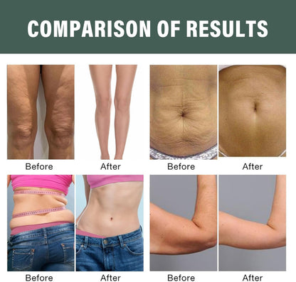 GlowTight – Skin Revitalizing Collagen Oil – image 5