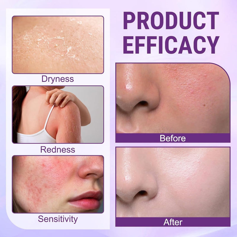 SkinRevive – Biotin 10-in-1 Skin Restoration Cream – image 7