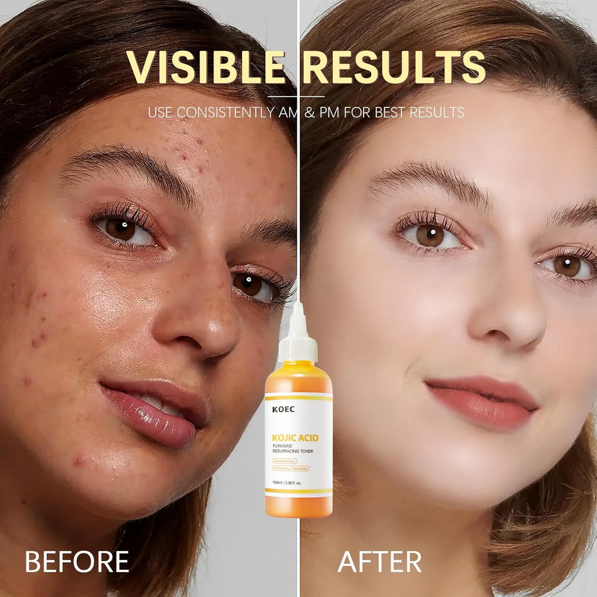 PureGlow – Kojic Acid Herbal Brightening Serum – image 16