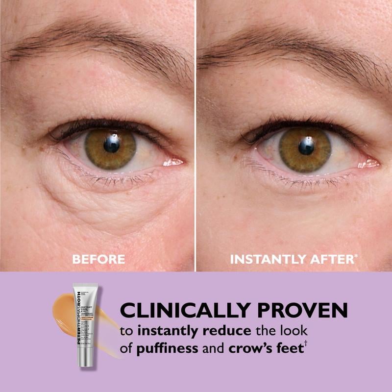 BlinkRevive – Instant Eye Tightening Solution – image 7